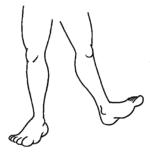 clipart arms and legs - photo #28